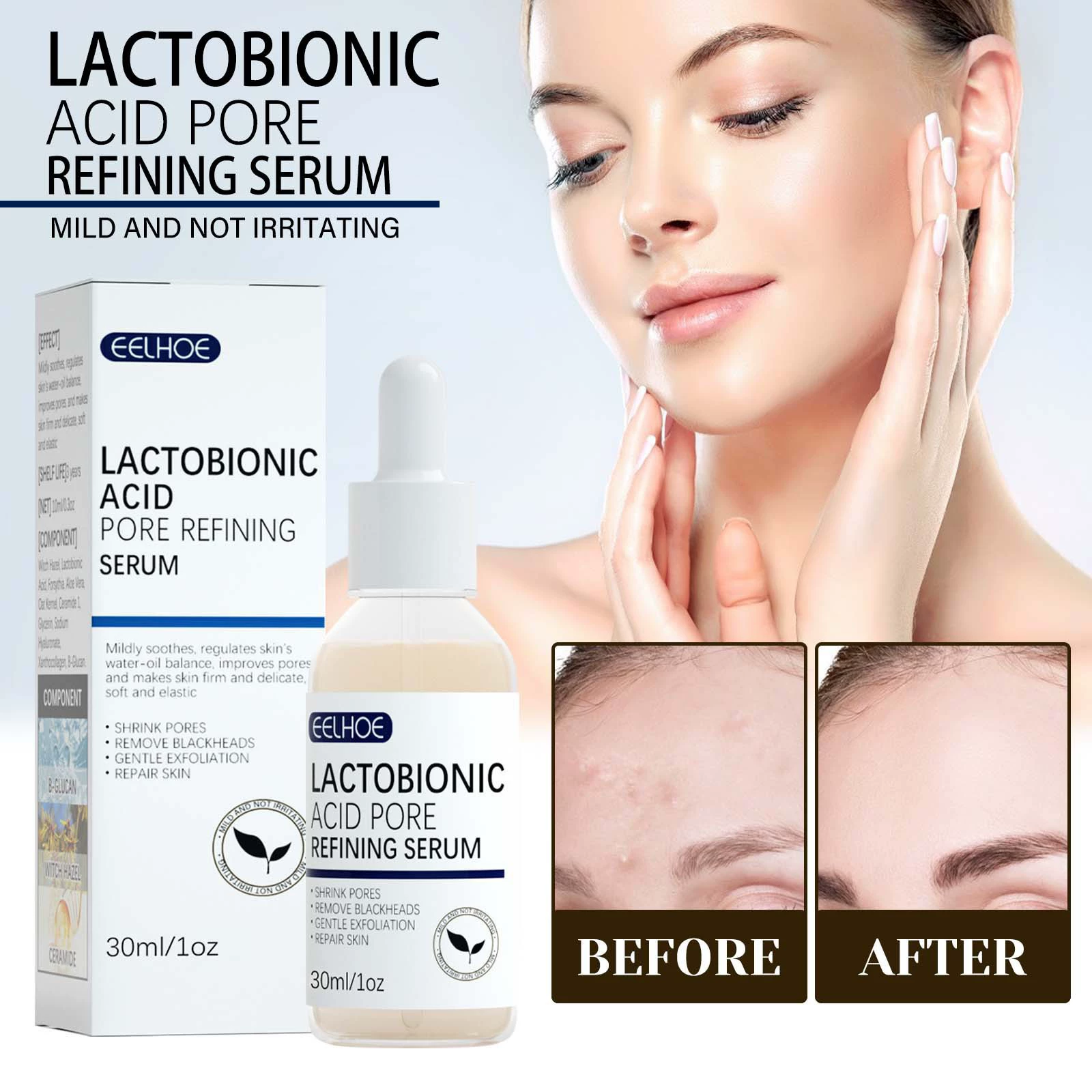 EELHOE лактонат, сокращающий поры, сыворотка, увлажняющий кожу, нежный и восстанавливающий Чистый угри, уход за кожей