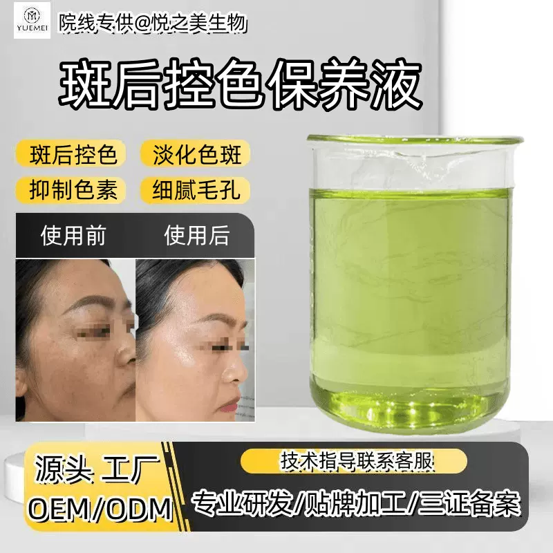 祛斑保养液调肤液排斑精华液控色防回流防反黑改善暗沉美容院专用