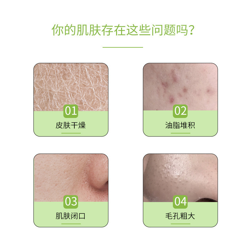 アロエベラジェル 300g アロエベラジェル 本物の保湿エッセンスミルク 肌の質感を改善 繊細な毛穴 アロエベラクリーム|undefined