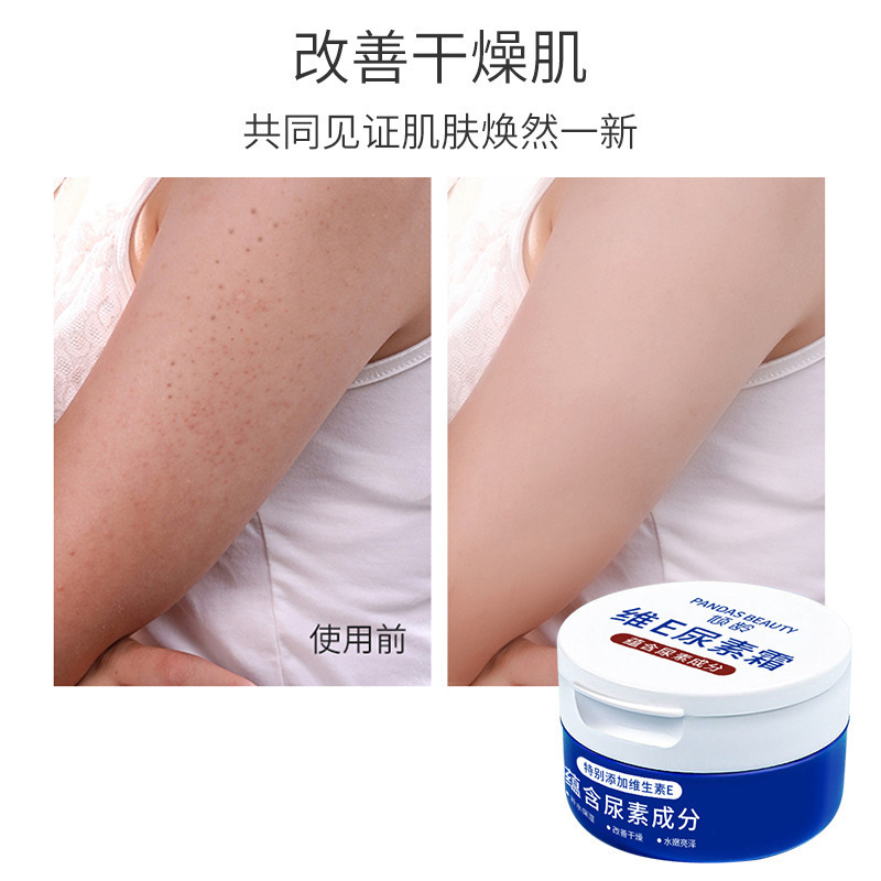 Qingling ビタミン E 尿素クリーム 保湿、さわやか、べたつかない、不凍液、乾燥防止、保湿ローション、ソフトキューティクルボディローション|undefined