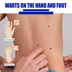 ouhoe 克疣膏 祛瘊疣平雞眼膏皮膚扁平肉粒疣手足修護點痣克疣膏