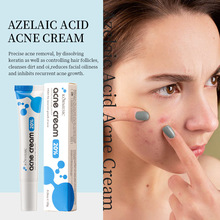 KORMESIC壬二酸净痘霜Acne removing cream跨境外贸厂家批发