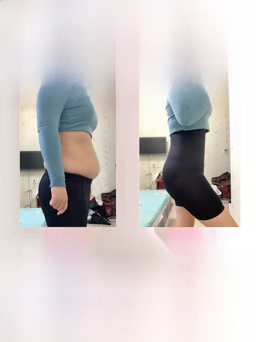 Women's Abdominal Compression Suspended Pants for Slimming and Postpartum Shaping, High-Waisted Waist Cincher for Hip Reduction and Buttock Elevation, Body Shaping and Beauty Enhancement