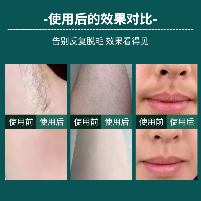 新款家用医用冰点脱毛仪器 全身腋下私处脱毛神器 女士专用剃毛机 新款家用医用冰点脱毛仪器 全身腋下私处脱毛神器 女士专用剃毛机