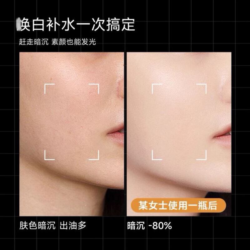 倍悠佳光感精华小黑瓶提亮肤色保湿面部精华改善暗沉军训学生|undefined