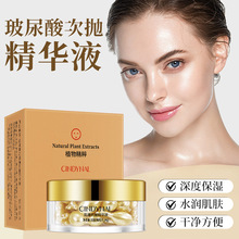 �ɵ��΃����������z�ҴΒ����AҺ�����B�w�o�� �S��ֱ�N���l