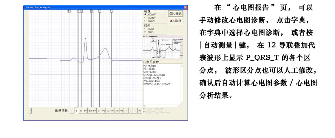 心电软件-5