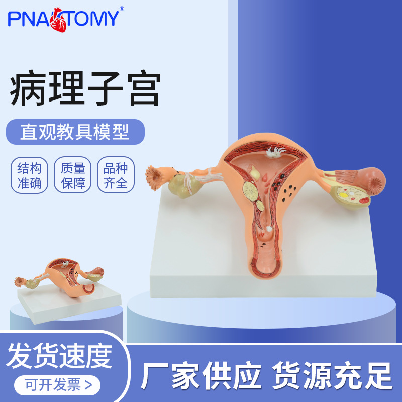 human body Model Female sex Reproduction Uterus Vagina Ovary Uterus teaching mould Pathology Change Polular Science train Teaching aids