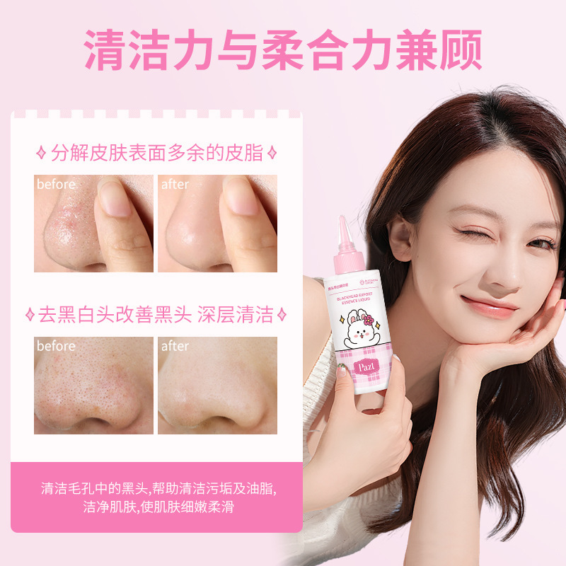 PAZT黑头导出液收缩毛孔深层清洁粉刺祛痘保湿温和不刺激批发|undefined