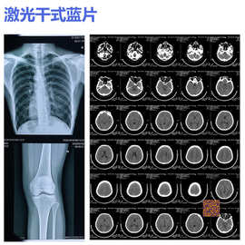 医院用蓝色激光干式胶片 彩色激光胶片 X光 CR DR CT MRI放射科胶