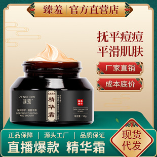 Zhenshy Skin Smooth Repair Cream Smoothing Marks Repair Cream Postpartum Repair Smoothing Skin Soothing Cream Removes Acne Marks