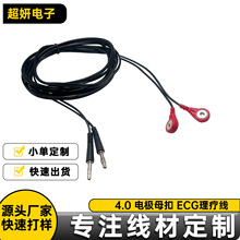 �����㽶�^�D4.0늘Oĸ��ECG������һ�϶���ܛ���Ό����ӿ�