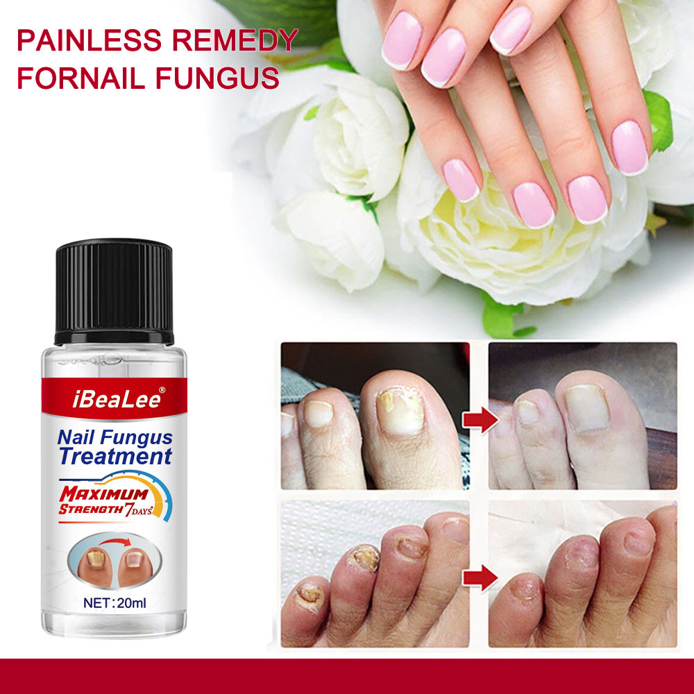 Líquido antibacteriano Crema de eliminación IBeaLee Poción especial espesante para uñas grises suaves_voghion.com