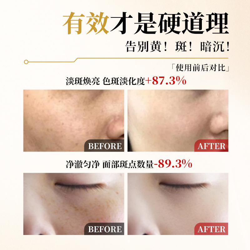 免提取祛斑排色液黄褐斑 点斑水分解 色素色沉美白调肤美容院专供|undefined