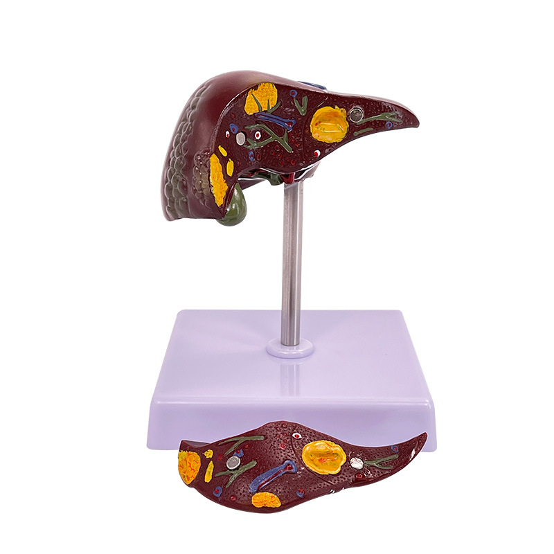 ���ಡ��ģ�� ֬��ģ�� �ε�ģ�� ����� ��������������ģ��