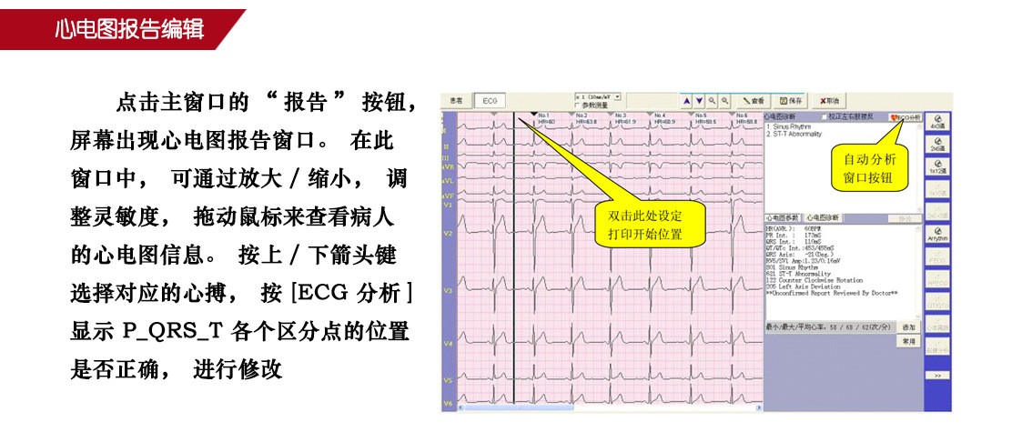 心电软件-4