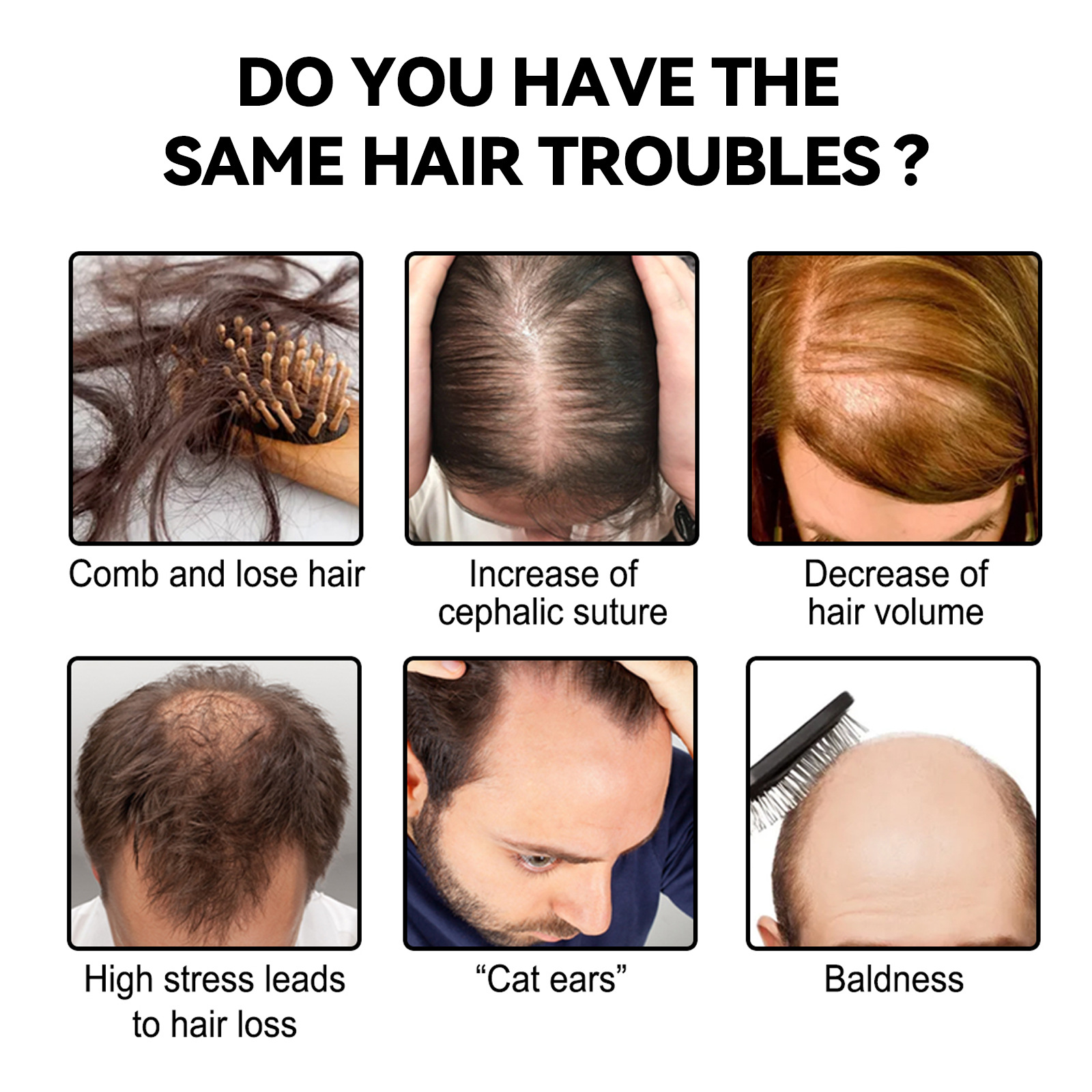 EELHOE Car Strong, Anti Breaking, Moisturizing and Nutritious Growth Black Ginger Hair_voghion.com