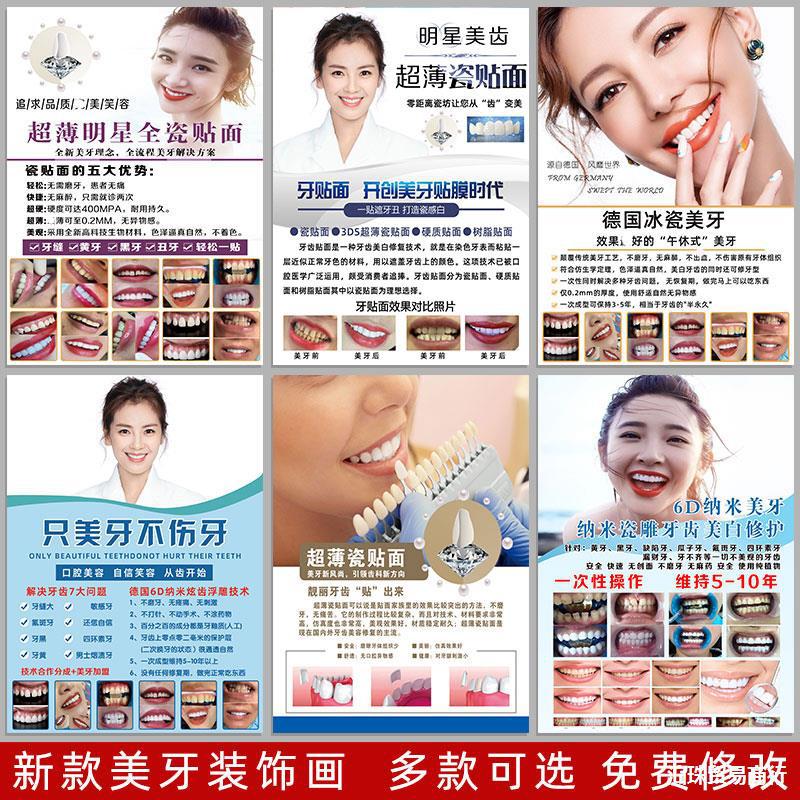 美牙广告牙贴片宣传画瓷贴面口腔装饰画牙齿美白图片全瓷贴面海报