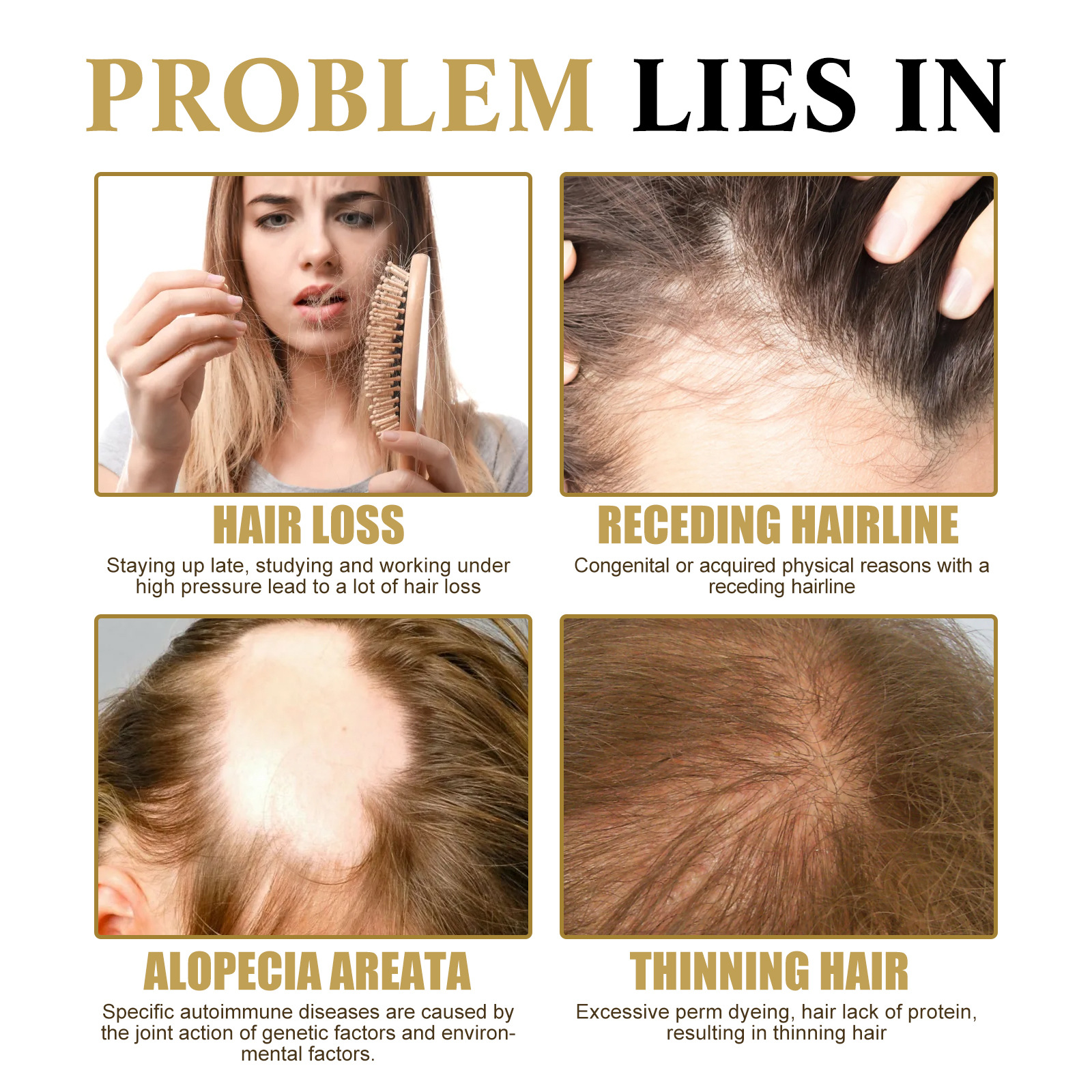 Le massage du cuir chevelu dense West&Month hydrate les racines Boule de soin des cheveux épaisse, douce et lisse_voghion.com