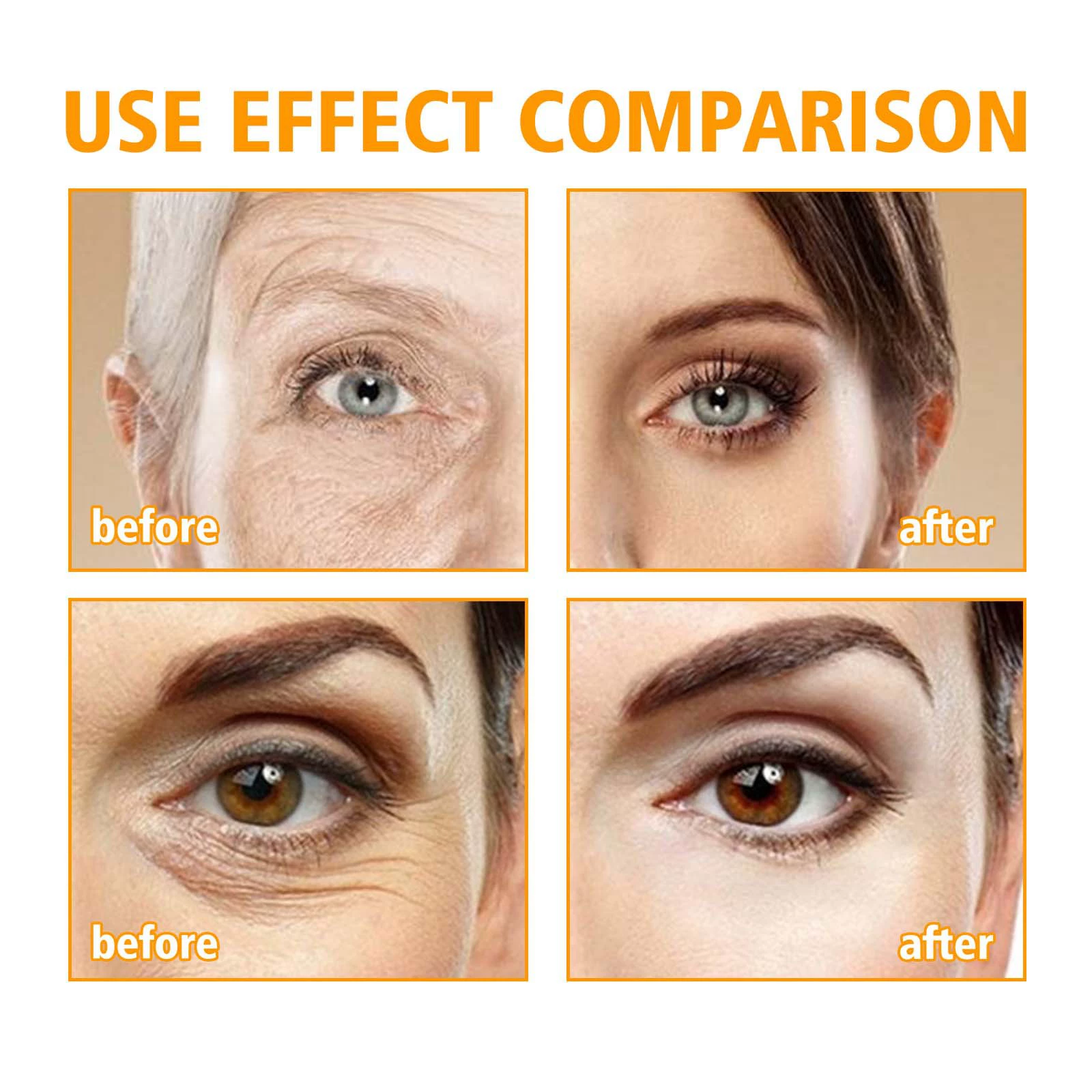 HOYGI Medical nutritious moisturizing eye cream