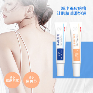 Zhen Shame Vitamin A Acid Cream Exfoliating Urea Vitamin E Cream Exfoliating Chicken Skin Melanin and Blackhead Acne Removal Ointment Wholesale
