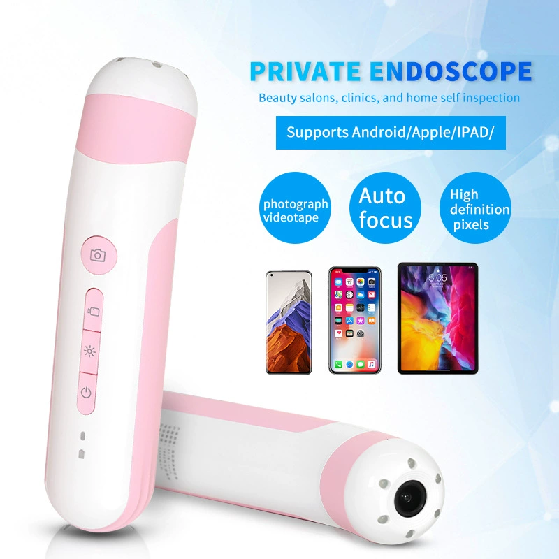 Гинекологический вагинальный эндоскоп высокого разрешения, электронный детектор шейки матки, устройство для самостоятельного осмотра интимных зон, электронный вагинальный эндоскоп.