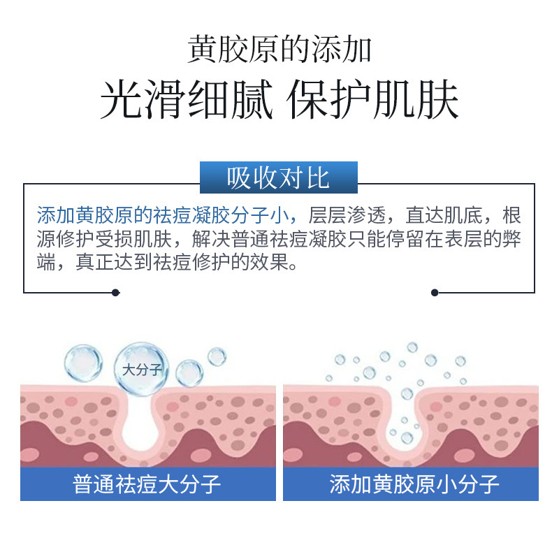 广药白云山祛痘舒缓凝胶水杨酸壬二酸组合祛痘膏淡化痘印祛痘膏|undefined