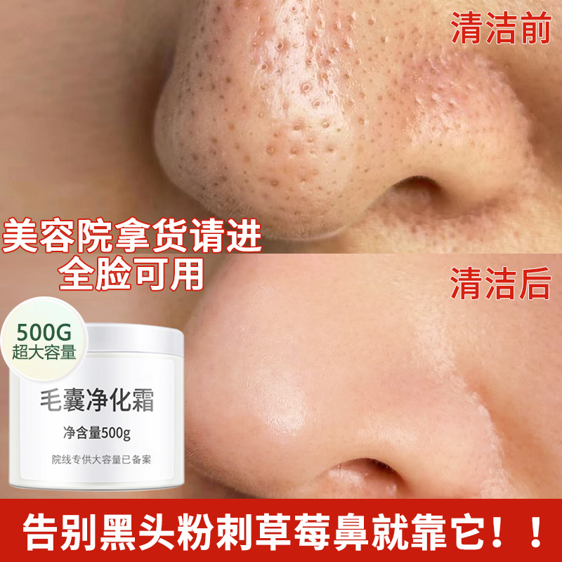 毛囊净化霜毛孔洁术祛黑头闭口粉刺洁草莓鼻缩毛孔美容院用现货|undefined