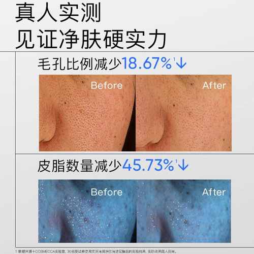 Eiio Clean Clay Mask for Deep Pore Cleansing, Hydration, Blackhead & Acne Treatment