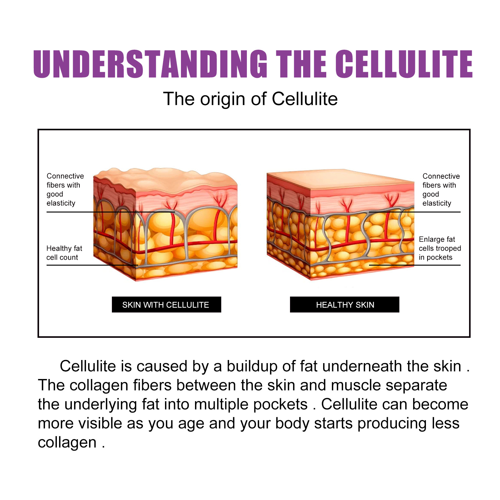 2024 gél Curve Body Shrinking feszesítő bőr comb- és karformáló krém_voghion.com