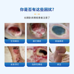 褥瘡紫草抑菌膏30g 老人臥床壓瘡黑痂清潔褥瘡護理外用塗抹膏批發