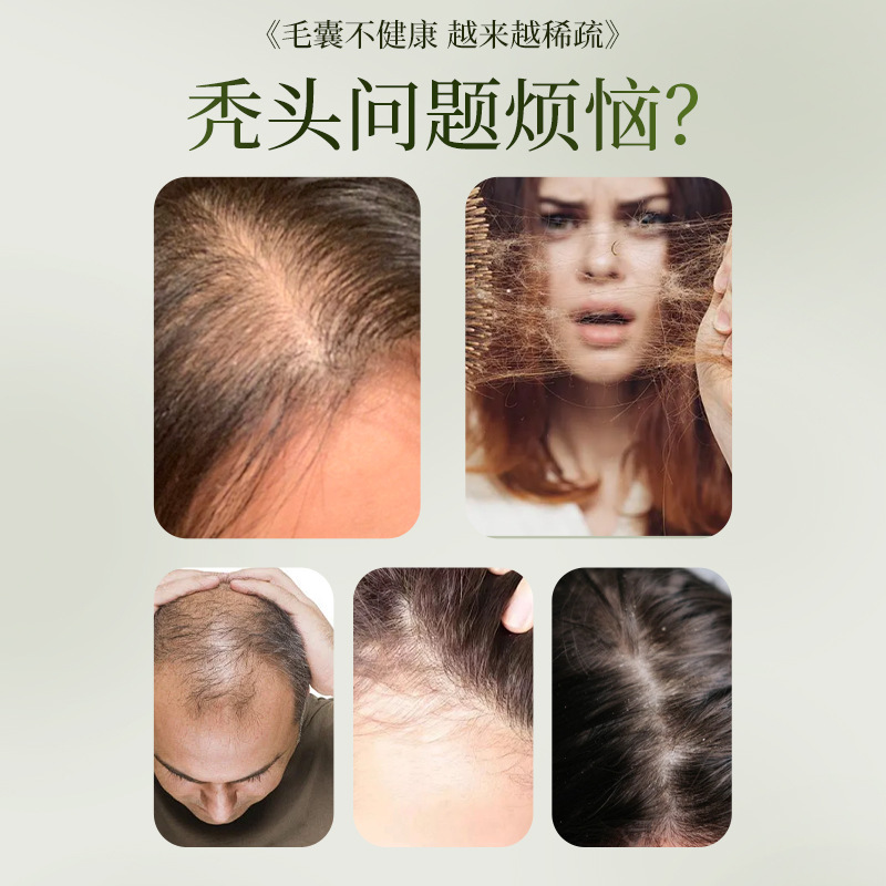 乌斯曼侧柏叶洗发皂草本固发养发护发抖音爆款手工侧柏叶洗发皂|undefined