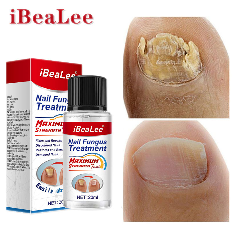 Líquido antibacteriano Crema de eliminación IBeaLee Poción especial espesante para uñas grises suaves_voghion.com