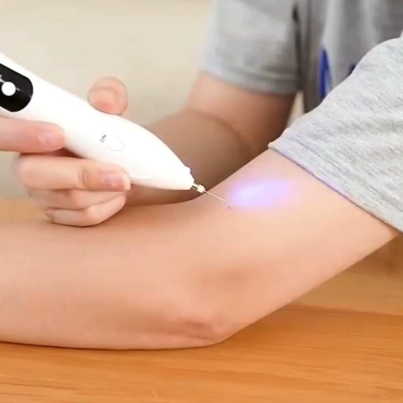 Маленькая белая ручка для молей, ручка для точечного сканирования, электрическая ручка для красоты, лазерный инструмент для красоты лица с микротатуировкой и ЖК-дисплеем
