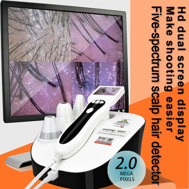 Пять спектральных телевизионных скальпа волосяного фолликула анализатор чешуи обнаружения трансграничного снабжения оптовая торговля Hair scalp