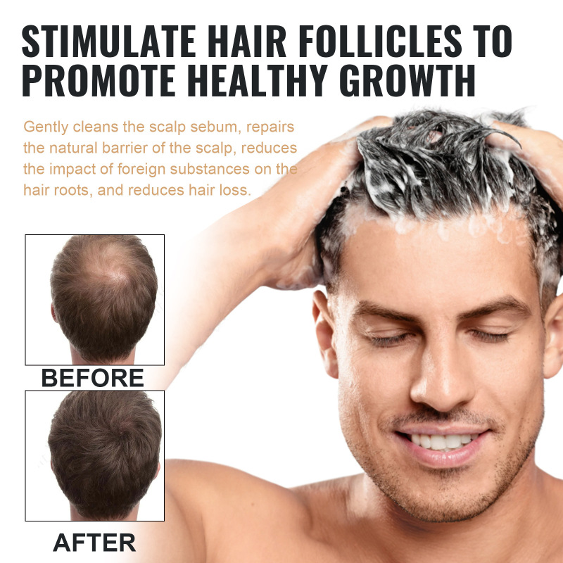 EELHOE シャンプー ジェントル クレンジング ヘア ナチュラル ふわふわ ヘア スムース ケア ヘアケア シャンプー|undefined