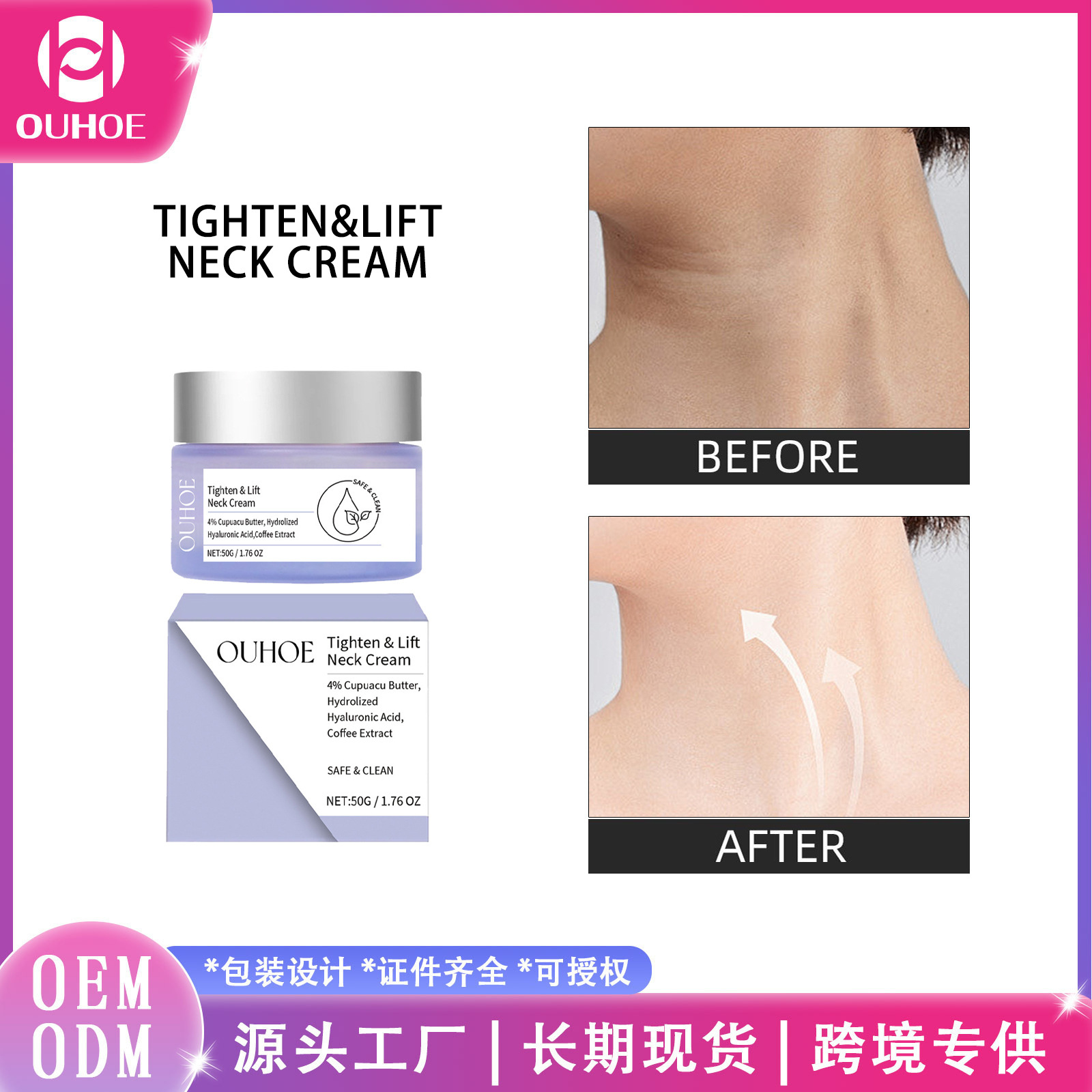 Ouhoe Moisturizing Neck Cream Cares for the Skin of the Neck, Moisturizes and Cares for It, Moisturizes and Smoothes It, Daily Care Neck Cream