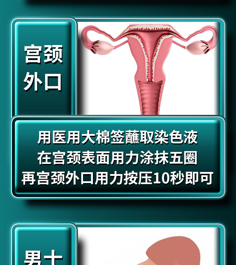 舒奈美hpv检测试纸 男女居家自检尖疣初筛染色液测试盒宫颈筛查