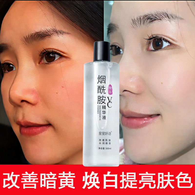 Nicotinamide stock solution with high concentration to improve dark yellow and brighten skin tone hydrating and moisturizing VC essence hospital wholesale