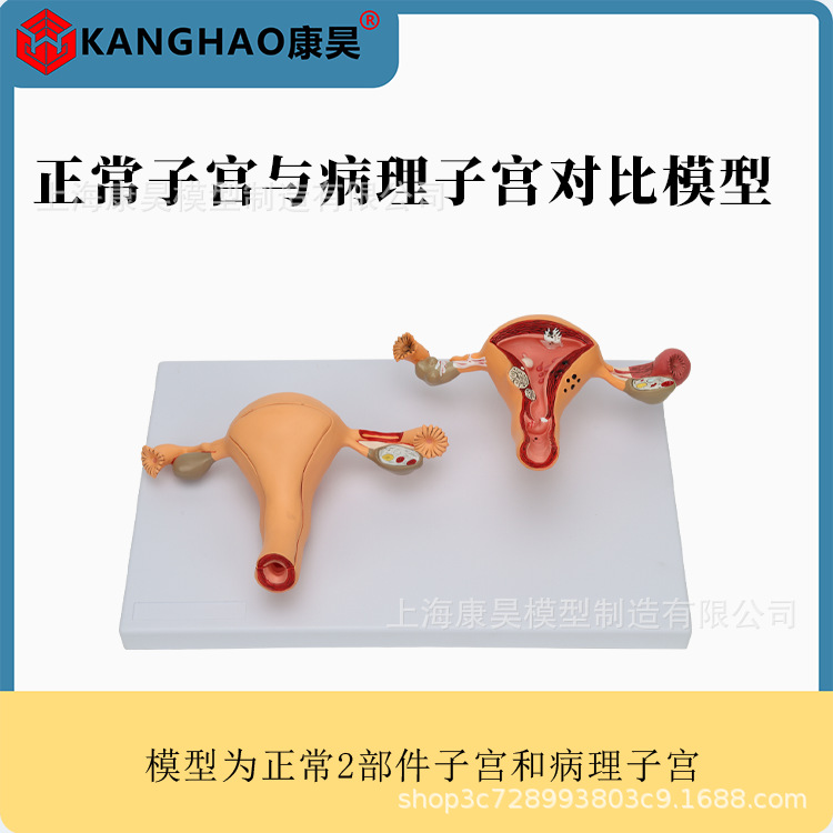 正常子宫与病理子宫对比模型 女性生殖子宫阴道卵巢子宫教学模具