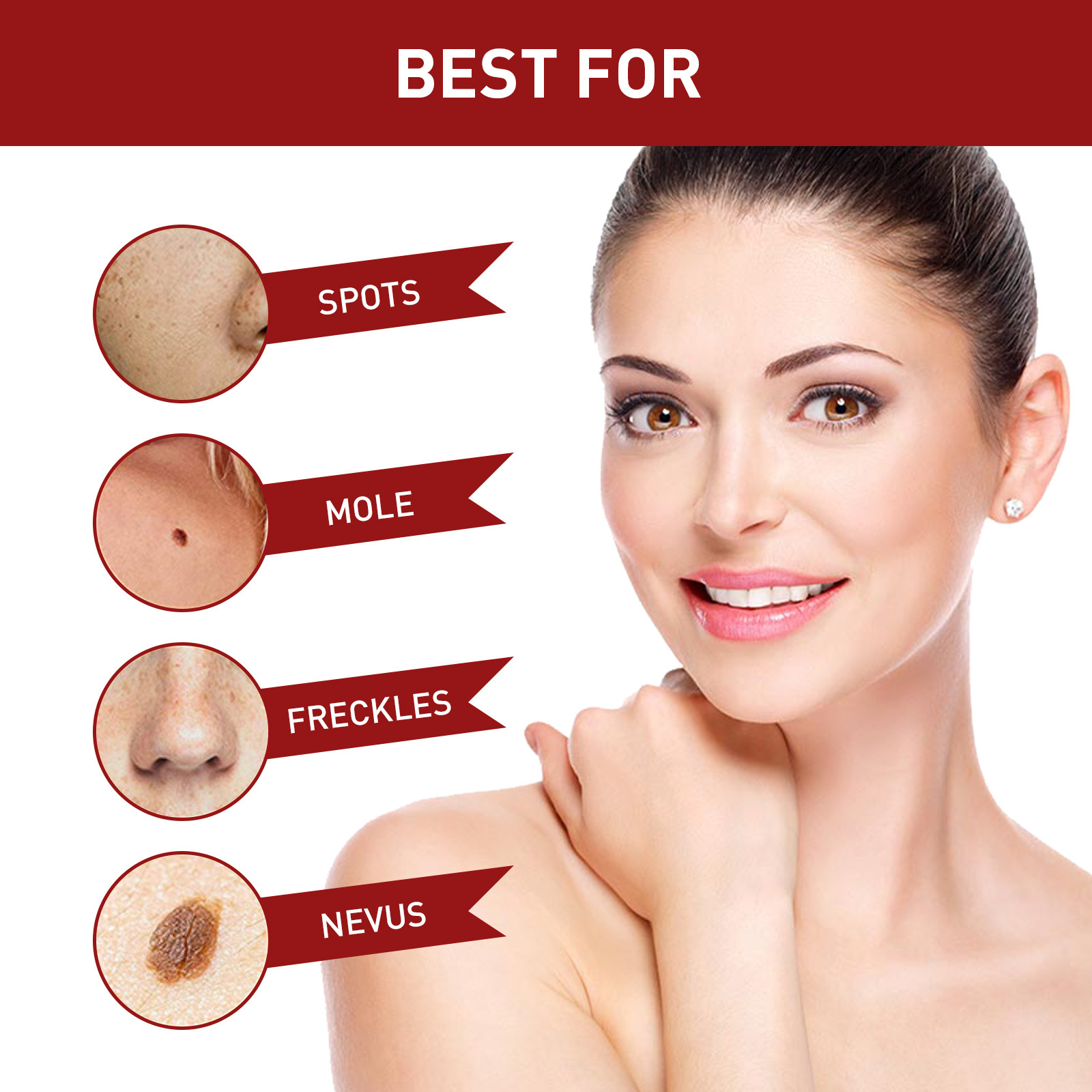 „South Mole“ apgamų šalinimo skystis, gilus odos valymas, karpų mažinimas, juodųjų apgamų atstatymas, odos lyginimo skystis_voghion.com