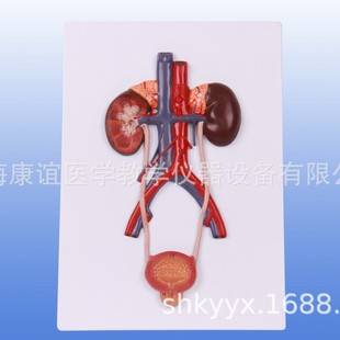 Kay-A14001 Urinary System Model Urinary and Reproductive System Anatomy Model Urinary and Reproductive Endocrine System