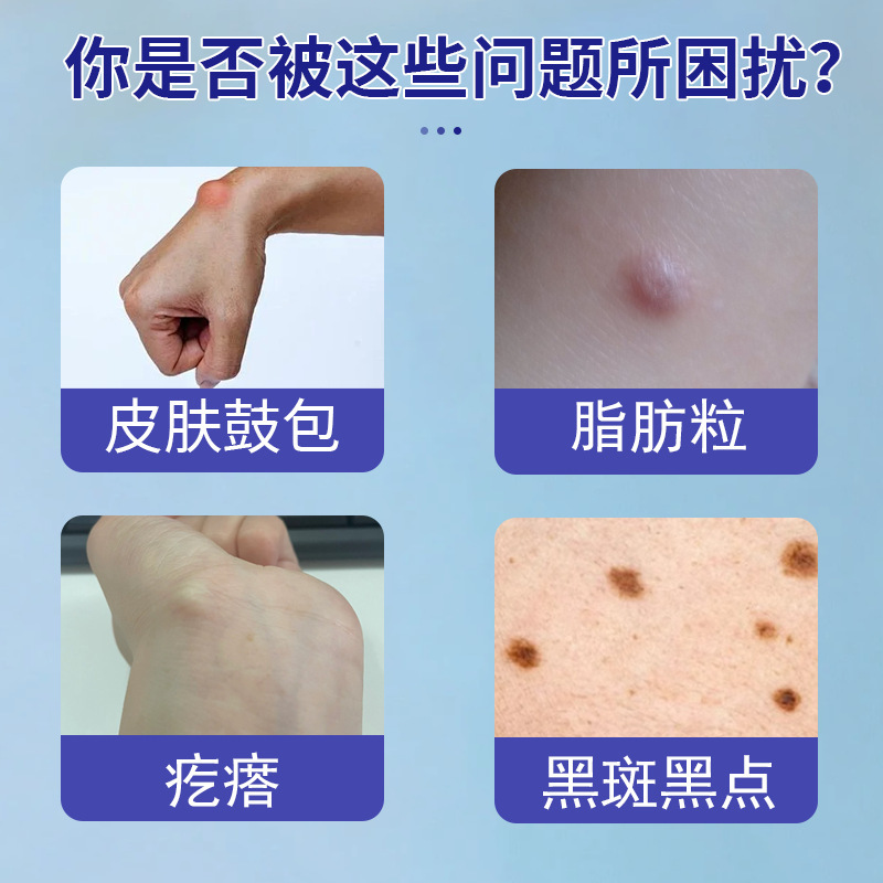 香港薬局ファットコンパッチ脂肪腫パッチファットコンパッチ全身多発性皮下脂肪除去パッチ|undefined