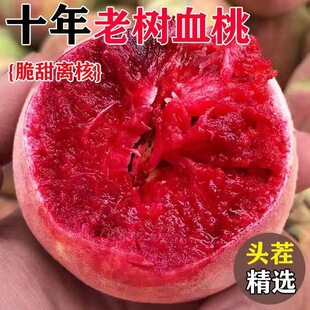 �����Ϙ�Ѫ�����r����ˮ���Fժ����5��t��ë�ҕr���ЋD��������