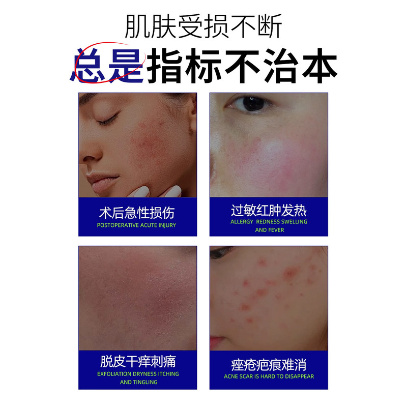 白云山水光激光祛斑术后冷敷贴敏感肌干燥保湿补水修复医用级面膜|undefined
