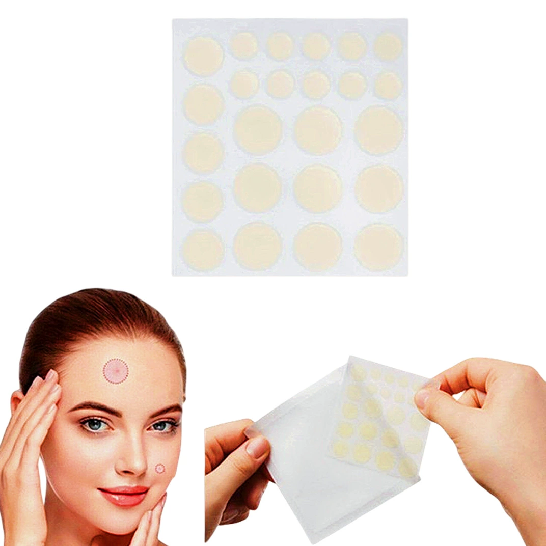 Прямые поставки с завода: пластыри от прыщей с эфирными маслами, гидроколлоидные пластыри от прыщей, невидимые водонепроницаемые пластыри из искусственной кожи, новые модели в наличии.