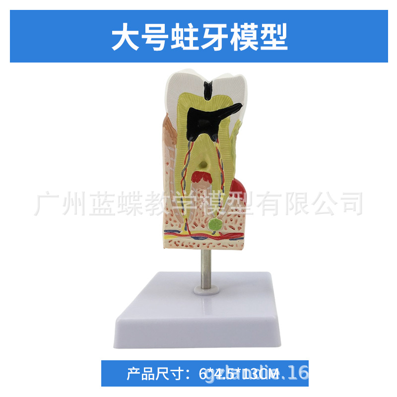 ���ƿ�ǻ�ı�ȣ�ݷֽ�ģ�� ����������ʾȣ�ݷ�չ���� ҽ����ͨ