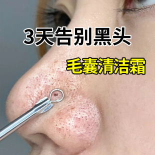 Hair Follicle Cleansing Cream, Beauty Salon Special Blackhead and Acne Removal Facial Hair Follicle Cleansing Cream, Pore Cleansing and Purifying Cream
