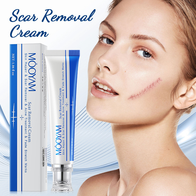 Cross-Border Scar Repairing Removing Scar Moisturizing Repair Cream Wholesale Scar Cream