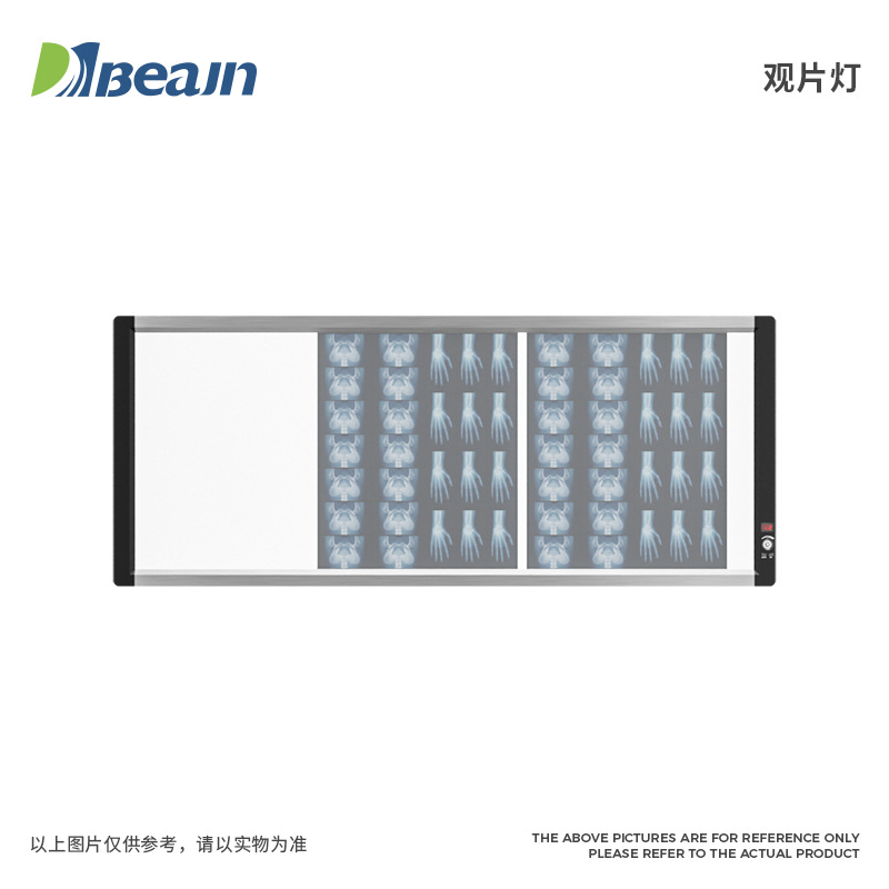 供应LED医用观片灯三联x光片观片灯四联阅片灯牙科LED六联观片灯